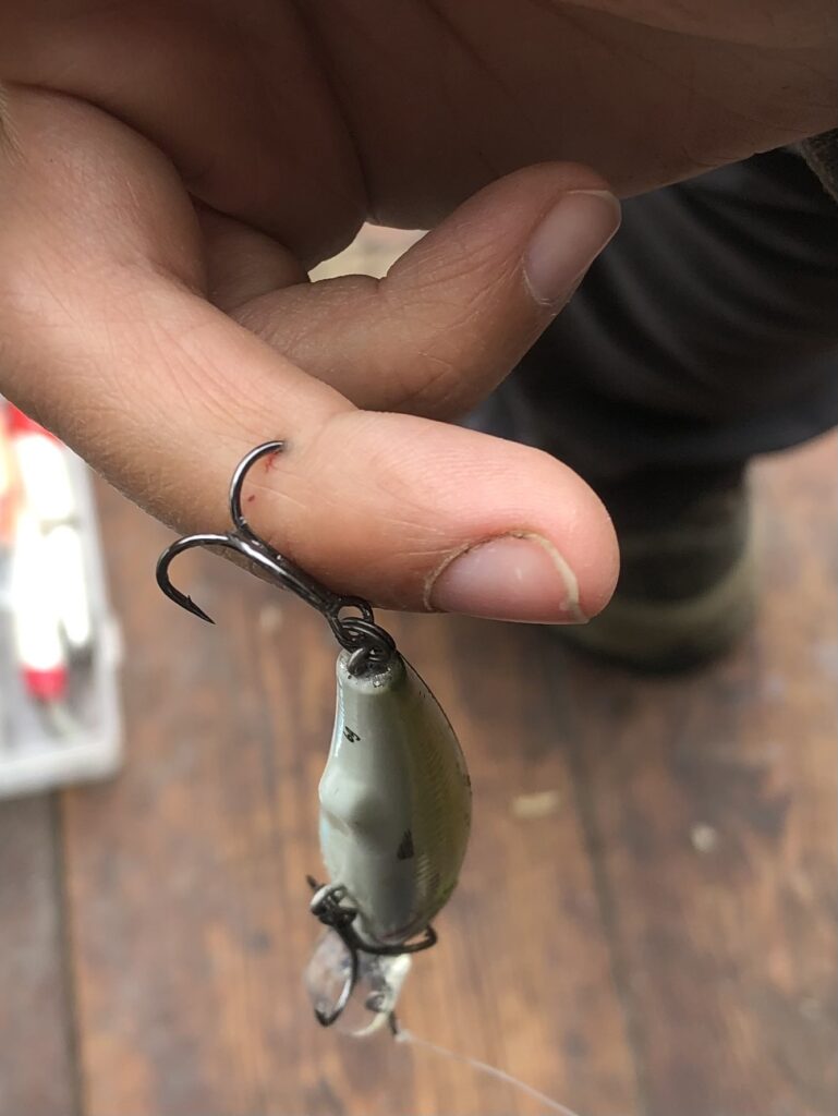 Treble hook stuck deep inside a finger joint capsule.